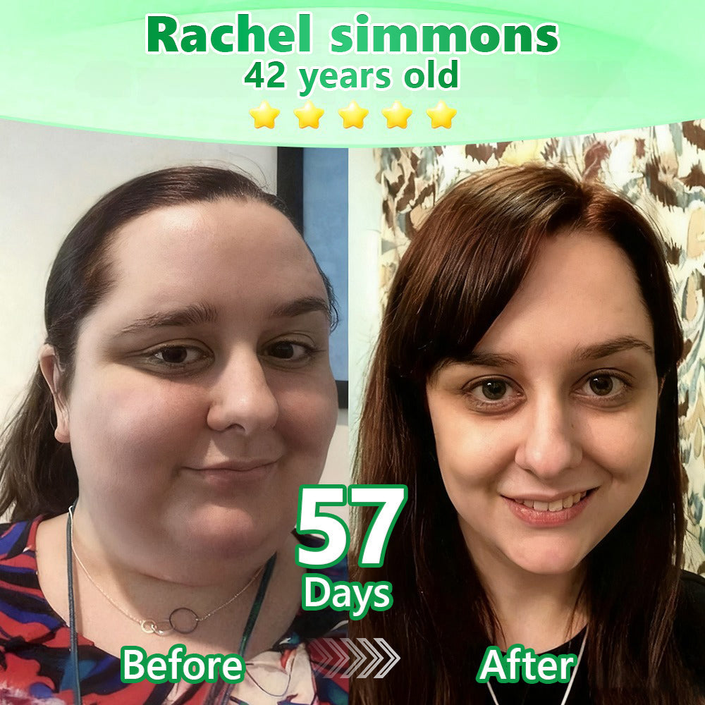 Certified by the Food Standards Agency (FSA)👩‍⚕️| 𝙇𝒐𝒕𝐦𝒂𝘆®  𝑮𝗟𝑷-1 𝟔-𝗶𝙣-𝟏 𝙊𝙧𝒂𝙡 𝗔𝙢𝙥𝙤𝙪𝙡𝙚𝒔 | 💊 Backed by science | 6-in-1 formula | Results in 7 days 🌴