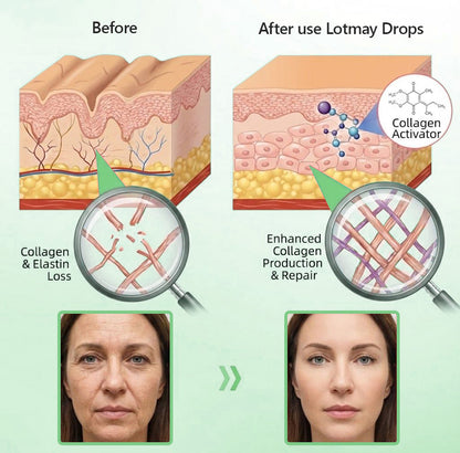 Exclusive Edition • Officially Authorised UK Release🔥|𝗟𝗼𝒕𝗺𝒂𝒚® 𝗬𝗼𝘂𝘁𝗵𝗚𝐥𝗼𝘄 𝗦𝘁𝗲𝗺 𝗖𝗲𝐥𝗹 𝗖𝗼𝗹𝐥𝗮𝗴𝗲𝗻 𝗗𝗿𝗼𝗽𝘀 💞 (𝑳𝒊𝒇𝒕 & 𝑭𝒊𝒓𝒎 𝑺𝒂𝒈𝒈𝒊𝒏𝒈 𝑺𝒌𝒊𝒏 & 𝑹𝒆𝒅𝒖𝒄𝒆 𝑾𝒓𝒊𝒏𝒌𝒍𝒆 𝑭𝒐𝒓𝒎𝒂𝒕𝒊𝒐𝒏)🔥🔥