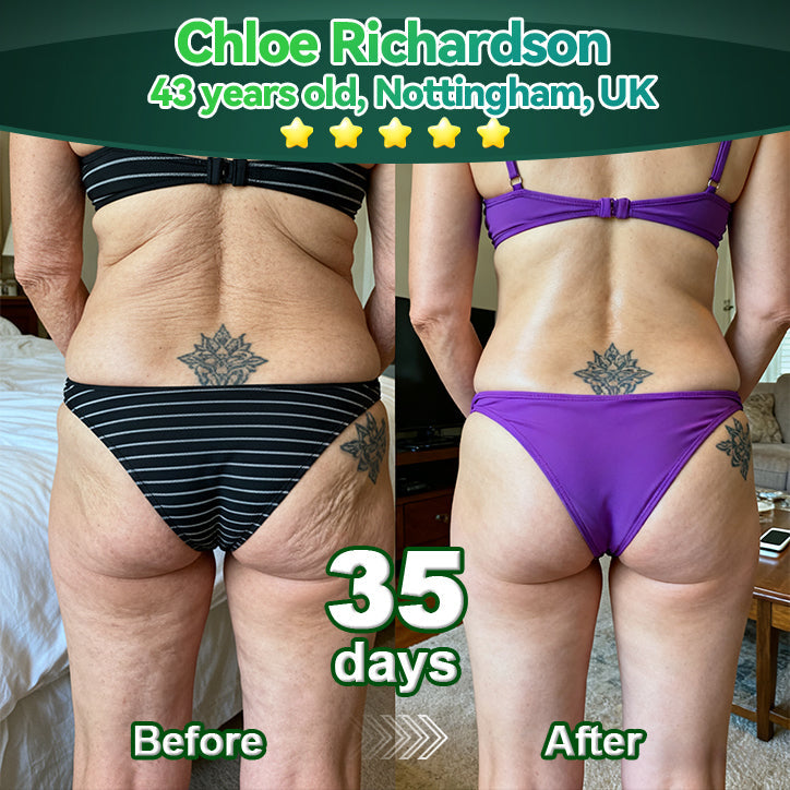 Exclusive Edition • Officially Authorised UK Release🔥|𝗟𝗼𝒕𝗺𝒂𝒚® 𝗬𝗼𝘂𝘁𝗵𝗚𝐥𝗼𝘄 𝗦𝘁𝗲𝗺 𝗖𝗲𝐥𝗹 𝗖𝗼𝗹𝐥𝗮𝗴𝗲𝗻 𝗗𝗿𝗼𝗽𝘀 💞 (𝑳𝒊𝒇𝒕 & 𝑭𝒊𝒓𝒎 𝑺𝒂𝒈𝒈𝒊𝒏𝒈 𝑺𝒌𝒊𝒏 & 𝑹𝒆𝒅𝒖𝒄𝒆 𝑾𝒓𝒊𝒏𝒌𝒍𝒆 𝑭𝒐𝒓𝒎𝒂𝒕𝒊𝒐𝒏)🔥🔥