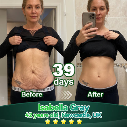 Exclusive Edition • Officially Authorised UK Release🔥|𝗟𝗼𝒕𝗺𝒂𝒚® 𝗬𝗼𝘂𝘁𝗵𝗚𝐥𝗼𝘄 𝗦𝘁𝗲𝗺 𝗖𝗲𝐥𝗹 𝗖𝗼𝗹𝐥𝗮𝗴𝗲𝗻 𝗗𝗿𝗼𝗽𝘀 💞 (𝑳𝒊𝒇𝒕 & 𝑭𝒊𝒓𝒎 𝑺𝒂𝒈𝒈𝒊𝒏𝒈 𝑺𝒌𝒊𝒏 & 𝑹𝒆𝒅𝒖𝒄𝒆 𝑾𝒓𝒊𝒏𝒌𝒍𝒆 𝑭𝒐𝒓𝒎𝒂𝒕𝒊𝒐𝒏)🔥🔥