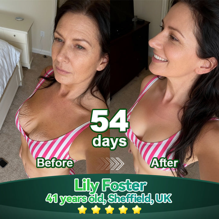 Exclusive Edition • Officially Authorised UK Release🔥|𝗟𝗼𝒕𝗺𝒂𝒚® 𝗬𝗼𝘂𝘁𝗵𝗚𝐥𝗼𝘄 𝗦𝘁𝗲𝗺 𝗖𝗲𝐥𝗹 𝗖𝗼𝗹𝐥𝗮𝗴𝗲𝗻 𝗗𝗿𝗼𝗽𝘀 💞 (𝑳𝒊𝒇𝒕 & 𝑭𝒊𝒓𝒎 𝑺𝒂𝒈𝒈𝒊𝒏𝒈 𝑺𝒌𝒊𝒏 & 𝑹𝒆𝒅𝒖𝒄𝒆 𝑾𝒓𝒊𝒏𝒌𝒍𝒆 𝑭𝒐𝒓𝒎𝒂𝒕𝒊𝒐𝒏)🔥🔥