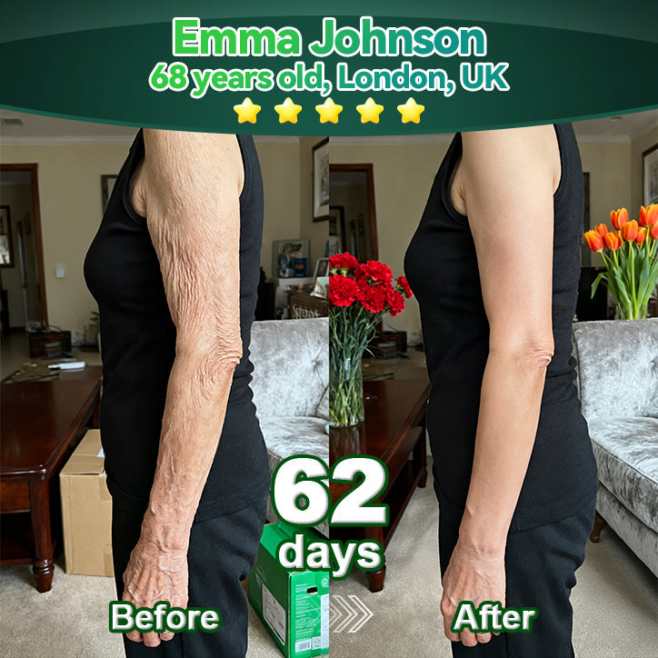 Exclusive Edition • Officially Authorised UK Release🔥|𝗟𝗼𝒕𝗺𝒂𝒚® 𝗬𝗼𝘂𝘁𝗵𝗚𝐥𝗼𝘄 𝗦𝘁𝗲𝗺 𝗖𝗲𝐥𝗹 𝗖𝗼𝗹𝐥𝗮𝗴𝗲𝗻 𝗗𝗿𝗼𝗽𝘀 💞 (𝑳𝒊𝒇𝒕 & 𝑭𝒊𝒓𝒎 𝑺𝒂𝒈𝒈𝒊𝒏𝒈 𝑺𝒌𝒊𝒏 & 𝑹𝒆𝒅𝒖𝒄𝒆 𝑾𝒓𝒊𝒏𝒌𝒍𝒆 𝑭𝒐𝒓𝒎𝒂𝒕𝒊𝒐𝒏)🔥🔥