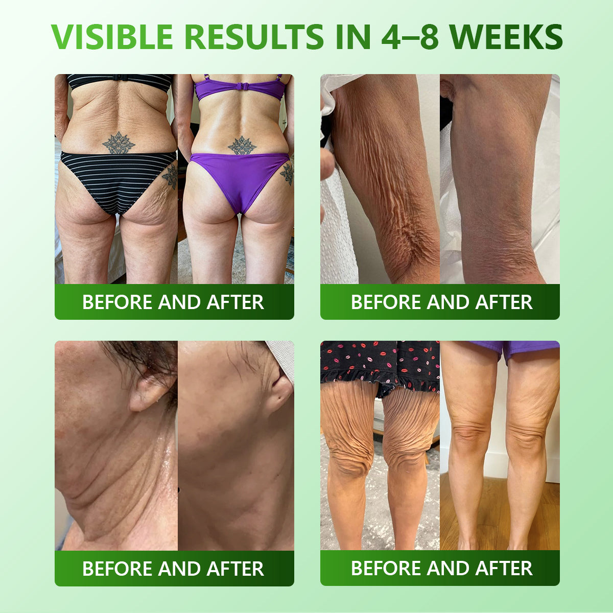 Exclusive Edition • Officially Authorised UK Release🔥|𝗟𝗼𝒕𝗺𝒂𝒚® 𝗬𝗼𝘂𝘁𝗵𝗚𝐥𝗼𝘄 𝗦𝘁𝗲𝗺 𝗖𝗲𝐥𝗹 𝗖𝗼𝗹𝐥𝗮𝗴𝗲𝗻 𝗗𝗿𝗼𝗽𝘀 💞 (𝑳𝒊𝒇𝒕 & 𝑭𝒊𝒓𝒎 𝑺𝒂𝒈𝒈𝒊𝒏𝒈 𝑺𝒌𝒊𝒏 & 𝑹𝒆𝒅𝒖𝒄𝒆 𝑾𝒓𝒊𝒏𝒌𝒍𝒆 𝑭𝒐𝒓𝒎𝒂𝒕𝒊𝒐𝒏)🔥🔥